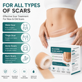 Derma Fade™ - Scar Removal Sheet