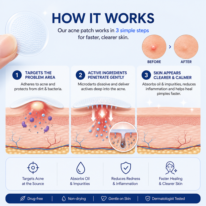 PimpleOut™ – Invisible Acne Patch